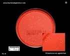 Group B streptococcus